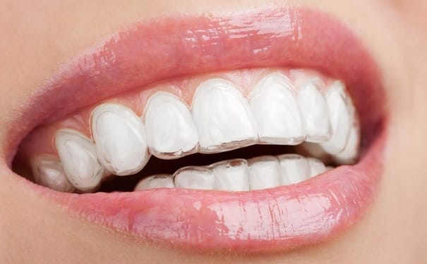 牙齿需要什么营养？吃什么对牙齿好？(1)