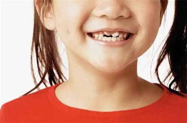 儿童换牙顺序是什么
