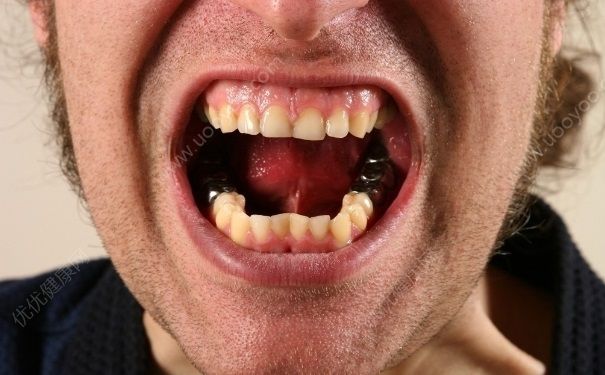 口腔溃疡能吃芒果吗？吃芒果对口腔溃疡有好处吗？(1)