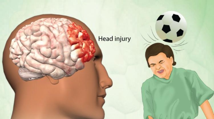 交通事故中颅脑损伤可以评残,颅脑损伤可以评残图4