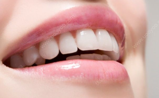 牙齿美白笔有用吗？牙齿美白笔怎么用？(1)